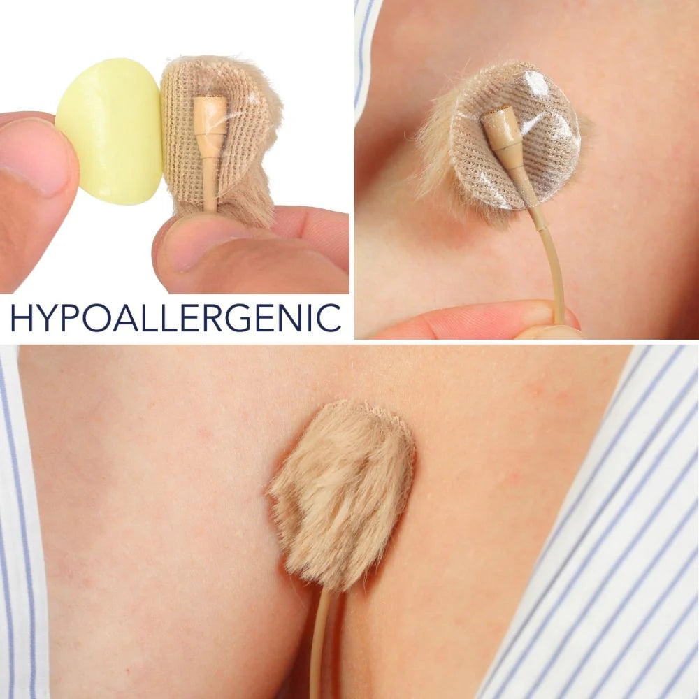 Hypoallergenic yellow adhesive circles shown on skin, close-up